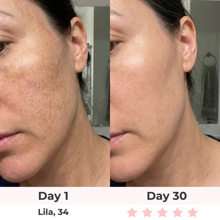 LumiSculpt 3-In-1 LED Facial Sculptor