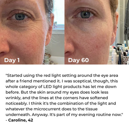 LumiSculpt 3-In-1 LED Facial Sculptor